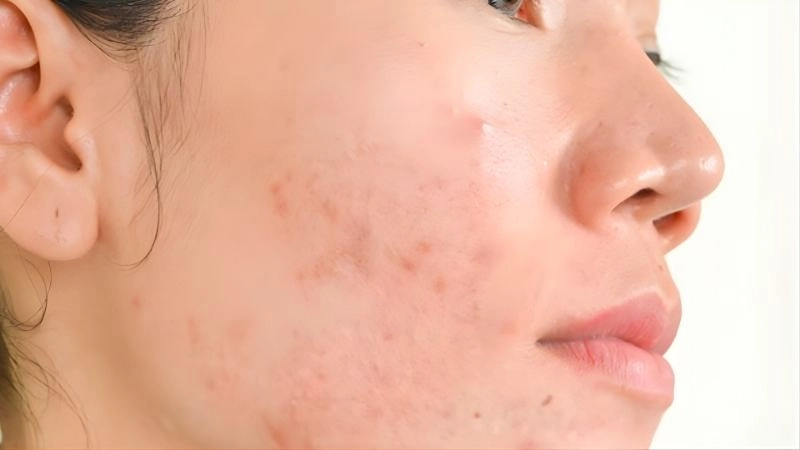 Lời khuyên vàng để bảo vệ nhan sắc bền vững